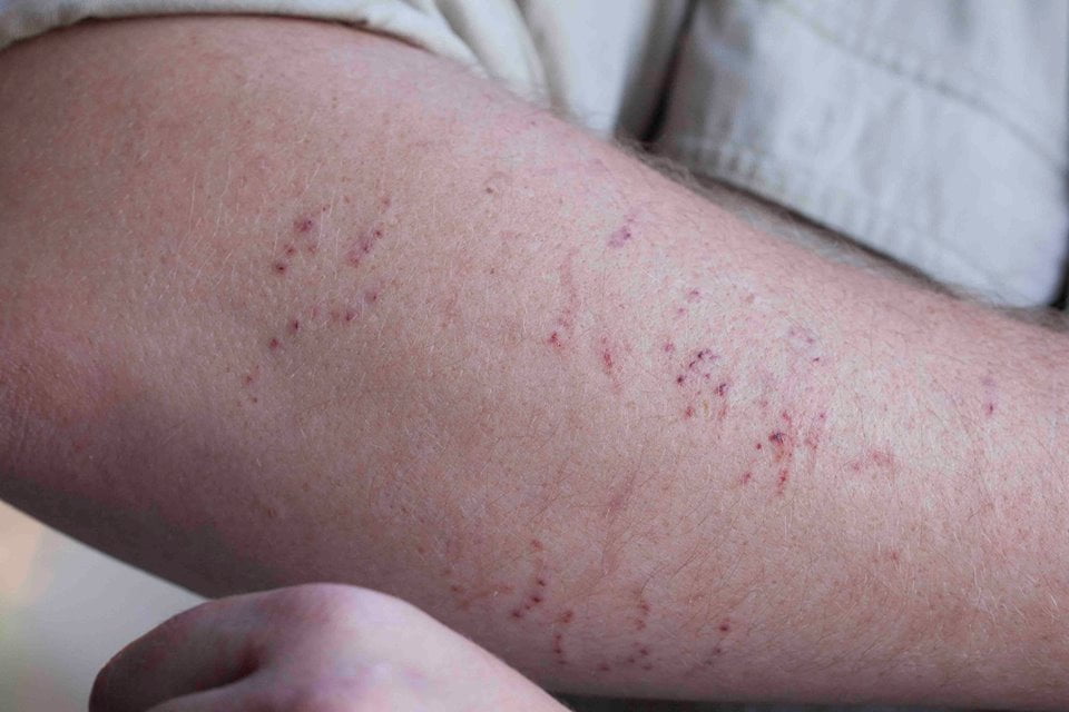 After the python bites